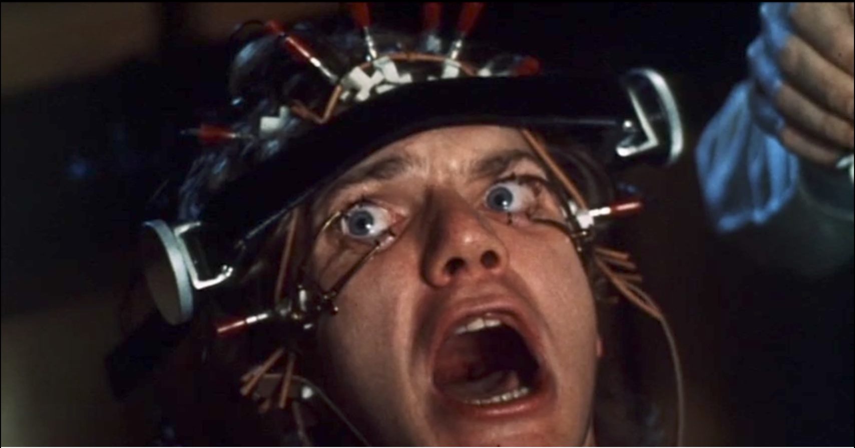 Malcolm McDowell as Alex in A Clockwork Orange, with his eyes held open during the Ludovico treatment